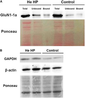 High Pressure Stress Response: Involvement of NMDA Receptor Subtypes and Molecular Markers